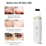 Load image into Gallery viewer, Beauty Ultrasonic Skin Scrubber